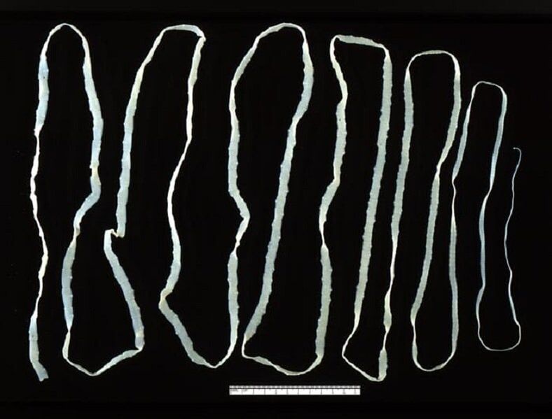 Tapeworms extracted from the human intestine