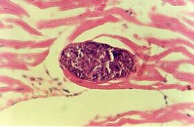 Parasitic