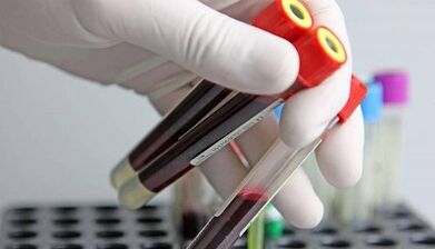 How to perform tests for parasites in the body