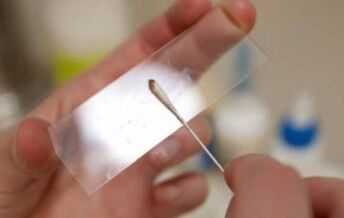 Which tests should be done for parasites