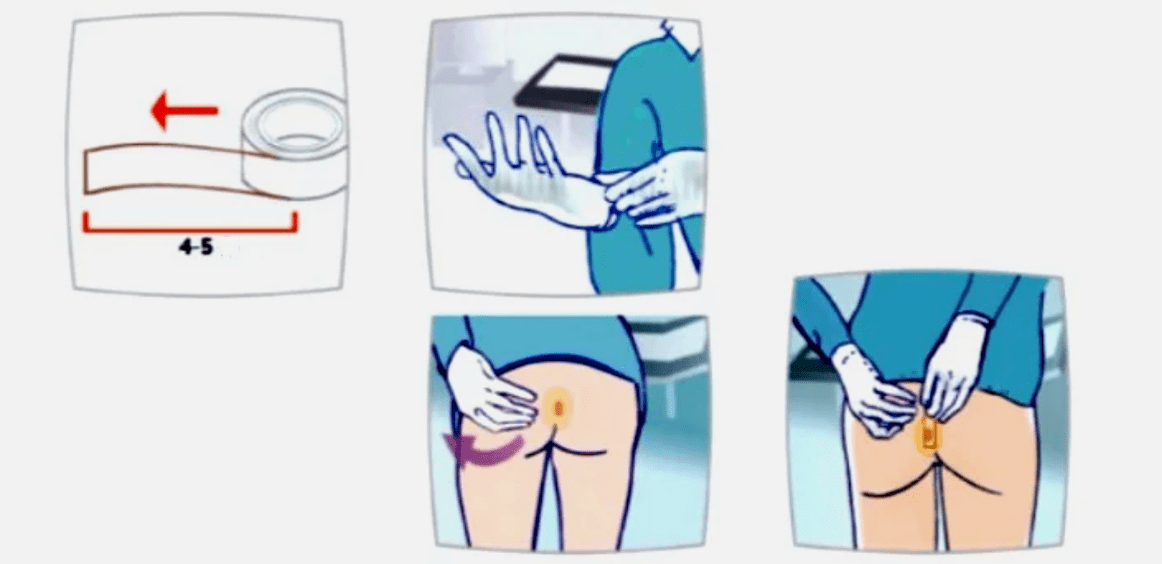 Scratch into parasites