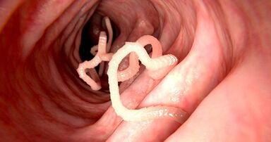 The cause of the parasite in the human body