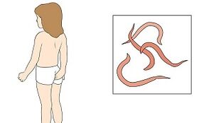 symptoms of the presence of the parasite in the human body