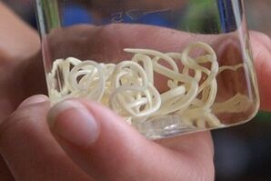 parasites from the human body