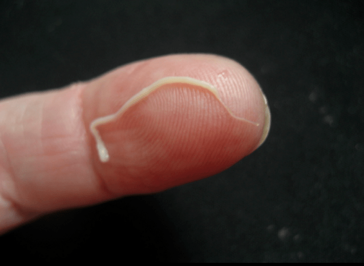 roundworm parasites from the human body